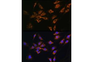 Immunofluorescence analysis of C6 cells using FGF2 Rabbit pAb (ABIN3020744, ABIN3020745, ABIN3020746 and ABIN6213702) at dilution of 1:100 (40x lens). (FGF2 抗体  (AA 143-288))
