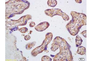 Formalin-fixed and paraffin embedded human placenta labeled with Rabbit Anti PAFAH2/Lp-PLA2 Polyclonal Antibody, Unconjugated (ABIN686722) at 1:200 followed by conjugation to the secondary antibody and DAB staining (PLA2G7 抗体  (AA 301-441))
