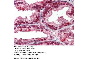 Immunohistochemistry with Human Prostate lysate tissue at an antibody concentration of 5. (NFIX 抗体  (Middle Region))