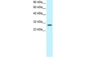 WB Suggested Anti-JMJD8 Antibody Titration:  0. (JMJD8 抗体  (Middle Region))