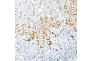 Immunohistochemistry of paraffin-embedded human esophageal using RPL7 antibody (ABIN6128656, ABIN6147148, ABIN6147149 and ABIN6221631) at dilution of 1:100 (40x lens). (RPL7 抗体  (AA 1-248))
