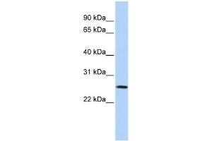 WB Suggested Anti-VGLL1 Antibody Titration: 0. (VGLL1 抗体  (Middle Region))