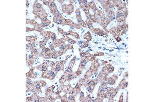 Immunohistochemistry (IHC) image for anti-ADAM Metallopeptidase Domain 15 (ADAM15) antibody (ABIN7265434)