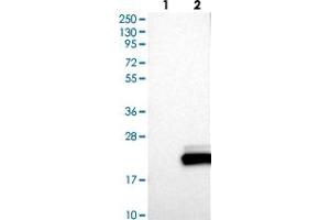 Western blot analysis of Lane 1: Negative control (vector only transfected HEK293T lysate) Lane 2: Over-expression lysate (Co-expressed with a C-terminal myc-DDK tag (~3. (UBE2L6 抗体)