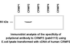 Image no. 2 for anti-Collapsing-Response Mediator Protein 2 (CRMP-2) (C-Term) antibody (ABIN347038) (Collapsing-Response Mediator Protein 2 (CRMP-2) (C-Term) 抗体)