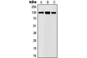 Western blot analysis of JAK1 (pY1022) expression in Ramos (A), Jurkat (B), L929 (C), PC12 (D) whole cell lysates. (JAK1 抗体  (C-Term, pTyr1022))