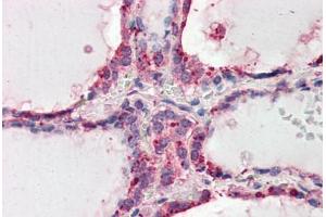Human Thyroid (formalin-fixed, paraffin-embedded) stained with WNT3 antibody ABIN461935 at 3. (WNT3 抗体  (AA 315-329))