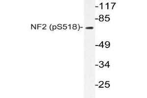 Western blot (WB) analyzes of p-NF2 antibody in extracts from Jurkat IFN cells. (Merlin 抗体  (pSer518))