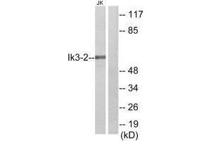 Western blot analysis of extracts from Jurkat cells, using Ik3-2 antibody. (CABLES2 抗体)