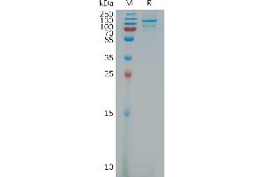 Human Protein, His Tag on SDS-PAGE under reducing condition.