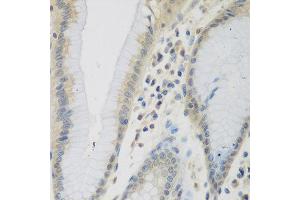 Immunohistochemistry of paraffin-embedded human stomach using CCL26 antibody at dilution of 1:200 (40x lens).
