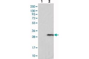 Western blot analysis of Lane 1: Negative control (vector only transfected HEK293T lysate), Lane 2: Over-expression Lysate (Co-expressed with a C-terminal myc-DDK tag (~3. (C1ORF109 抗体)
