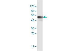 Western Blot detection against Immunogen (59. (AKR1E2 抗体  (AA 1-307))