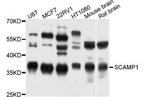 Western blot analysis of extract of various cells, using SCAMP1 antibody. (SCAMP1 抗体)