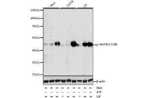 Western blot analysis of extracts of various cell lines, using Phospho-MAP2K1-S298 antibody. (MEK1 抗体  (pSer298))