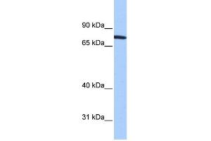 WB Suggested Anti-ZNF45 Antibody Titration:  0. (ZNF45 抗体  (N-Term))