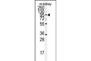 Western blot analysis of anti-ADAM9 Antibody in mouse kidney tissue lysates (35ug/lane)