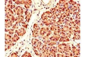 Immunohistochemistry of paraffin-embedded human pancreatic tissue using ABIN7164097 at dilution of 1:100 (PRDM4 抗体  (AA 301-500))
