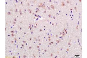 Formalin-fixed and paraffin embedded rat brain labeled with Anti-RNF123 Polyclonal Antibody, Unconjugated  at 1:200 followed by conjugation to the secondary antibody and DAB staining (RNF123 抗体  (AA 2-52))
