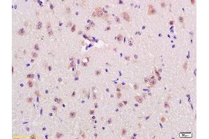 Formalin-fixed and paraffin embedded rat brain labeled with Anti-RNF123 Polyclonal Antibody, Unconjugated  at 1:200 followed by conjugation to the secondary antibody and DAB staining