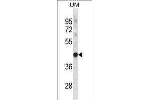 TRUB1 Antibody (Center) (ABIN656716 and ABIN2845945) western blot analysis in uterus tumor cell line lysates (35 μg/lane). (TRUB1 抗体  (AA 152-180))