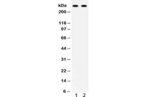 Western blot testing of 1) human HeLa and 2) SW620 lysate with ITPR3 antibody. (ITPR3 抗体)