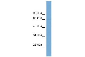 WB Suggested Anti-IL1RL2 Antibody Titration:  0. (IL1RL2 抗体  (N-Term))