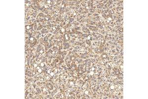 IHC analysis of SGCE using anti-SGCE antibody (ABIN7601544). (SGCE 抗体  (AA 38-407))