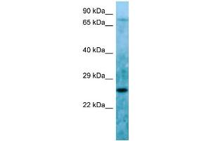 Host: Rabbit Target Name: C11orf48 Sample Type: HepG2 Whole Cell lysates Antibody Dilution: 1. (C11orf48 抗体  (C-Term))