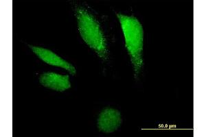 Immunofluorescence of purified MaxPab antibody to DNASE2 on HeLa cell. (DNASE2 抗体  (AA 1-360))