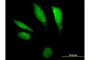 Immunofluorescence of purified MaxPab antibody to DNASE2 on HeLa cell. (DNASE2 抗体  (AA 1-360))