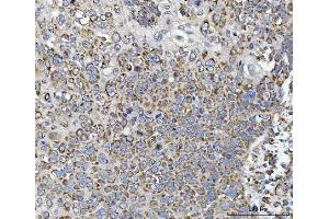 IHC analysis of Calnexin/CANX using anti-Calnexin/CANX antibody (ABIN7602289). (Calnexin 抗体  (AA 68-582))