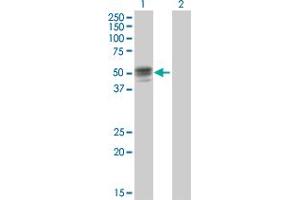 Western Blot analysis of GIF expression in transfected 293T cell line by GIF MaxPab polyclonal antibody. (Intrinsic Factor 抗体  (AA 1-417))