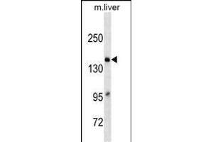 A2M Antibody (C-term)(Ascites) ABIN1539961 western blot analysis in mouse Liver tissue lysates (35 μg/lane). (alpha 2 Macroglobulin 抗体  (C-Term))