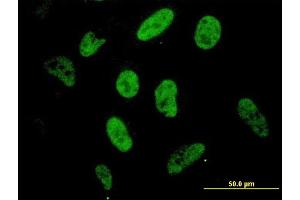 Immunofluorescence of monoclonal antibody to SP1 on HeLa cell. (SP1 抗体  (AA 89-198))
