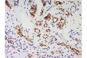 Formalin-fixed and paraffin embedded human kidney labeled with Anti-PNUTS/PPP1R10 Polyclonal Antibody Unconjugated  at 1:200 followed by conjugation to the secondary antibody and DAB staining. (PPP1R10 抗体  (AA 151-250))