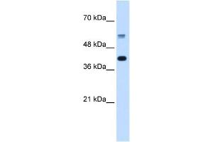 PUF60 antibody used at 5 ug/ml to detect target protein. (PUF60 抗体  (C-Term))