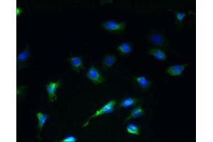 Immunofluorescent analysis of U251 cells using ABIN7168731 at dilution of 1:100 and Alexa Fluor 488-congugated AffiniPure Goat Anti-Rabbit IgG(H+L) (SCAMP4 抗体  (AA 170-228))