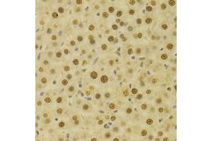 Immunohistochemistry of paraffin-embedded rat liver using HDGF Antibody (ABIN1876535) at dilution of 1:100 (40x lens). (HDGF 抗体)