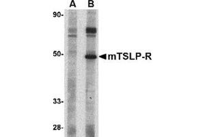 Western blot analysis of TSLP Receptor in mouse heart tissue lysate with this product at 1 μg/ml in (A) the presence and (B) the absence of blocking peptide. (CRLF2 抗体  (Center))