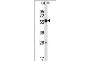 ZN Antibody (Center) (ABIN657288 and ABIN2846375) western blot analysis in CEM cell line lysates (35 μg/lane). (ZNF764 抗体  (AA 84-113))