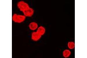 Immunofluorescent analysis of BUB3 staining in HeLa cells. (BUB3 抗体  (C-Term))