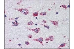 Immunohistochemistry (IHC) image for anti-Cathepsin D (CTSD) (AA 21-412) antibody (ABIN317502) (Cathepsin D 抗体  (AA 21-412))