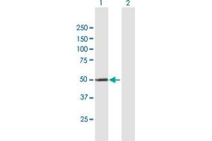 Western Blotting (WB) image for anti-Cytochrome P450, Family 4, Subfamily X, Polypeptide 1 (CYP4X1) (AA 1-509) antibody (ABIN531503)