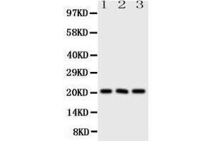 Western Blotting (WB) image for anti-Fibroblast Growth Factor 21 (FGF21) (AA 43-58), (N-Term) antibody (ABIN3044256) (FGF21 抗体  (N-Term))