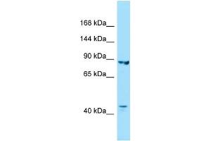 WB Suggested Anti-IPO8 Antibody Titration: 1. (Importin 8 抗体  (C-Term))
