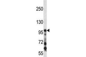 COL1A1 antibody western blot analysis in mouse kidney tissue lysate