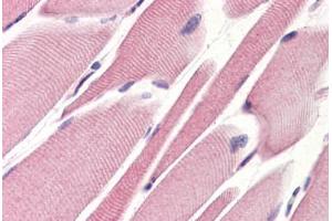 Human Skeletal Muscle (formalin-fixed, paraffin-embedded) stained with STEAP1 antibody ABIN364397 at 10 ug/ml followed by biotinylated anti-mouse IgG secondary antibody ABIN481714, alkaline phosphatase-streptavidin and chromogen. (STEAP1 抗体  (AA 1-70))