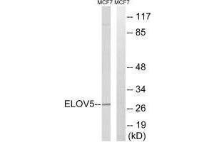 Western blot analysis of extracts from MCF-7 cells, using ELOVL5 antibody. (ELOVL5 抗体)