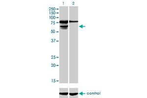 Western blot analysis of PGM3 over-expressed 293 cell line, cotransfected with PGM3 Validated Chimera RNAi (Lane 2) or non-transfected control (Lane 1).
